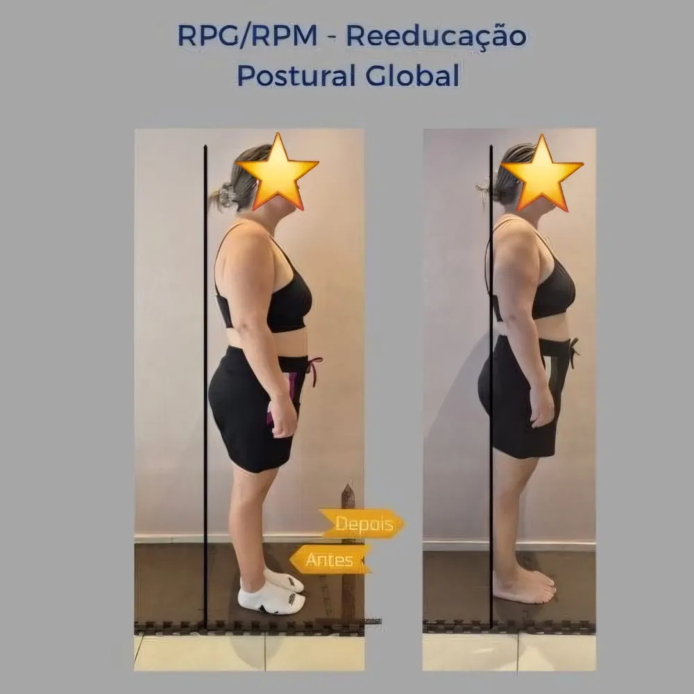 Resultado de tratamento na Benevento Fisioterapia