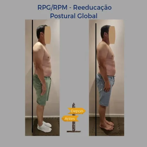 Resultado de tratamento na Benevento Fisioterapia